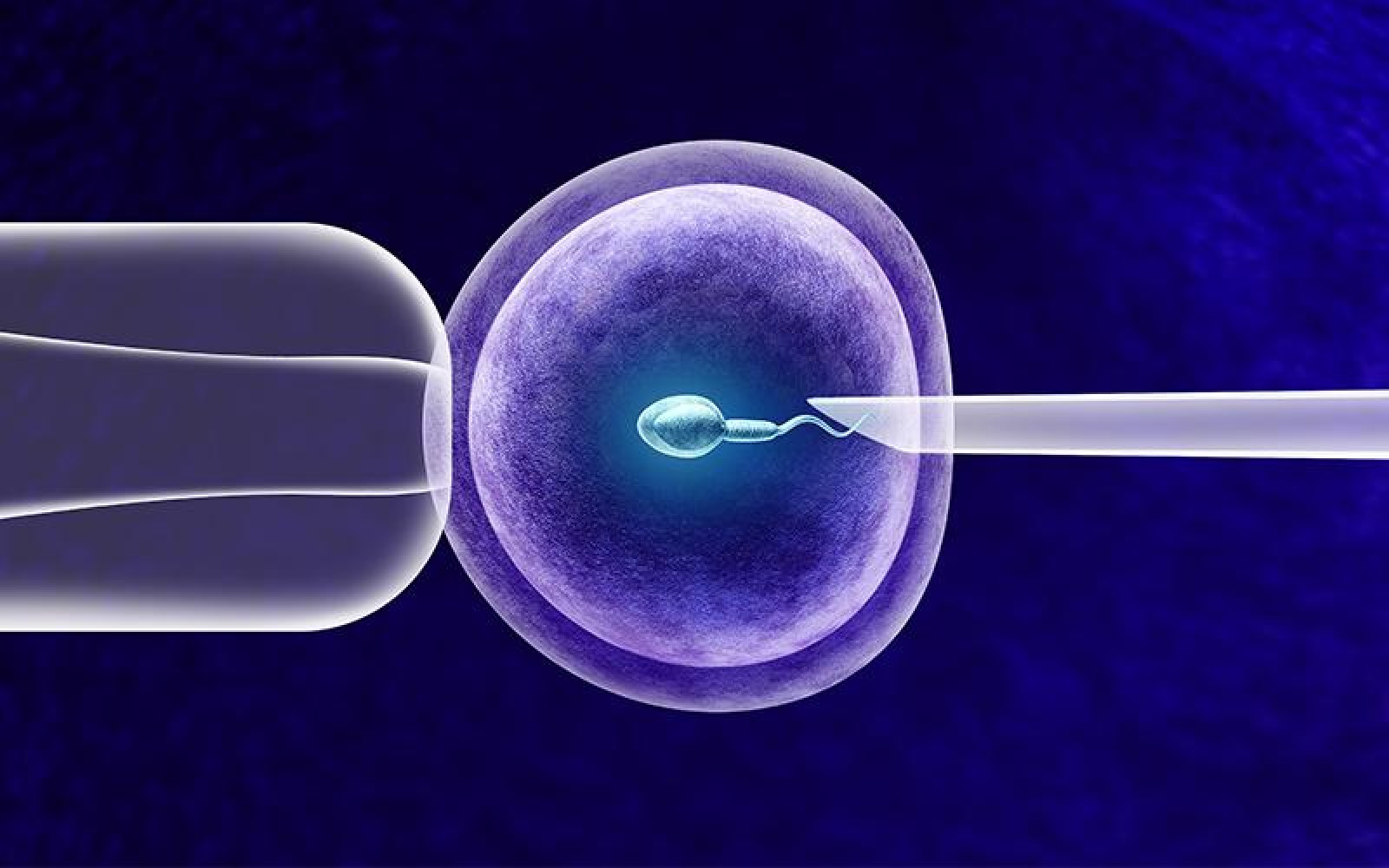 Fertilização in Vitro